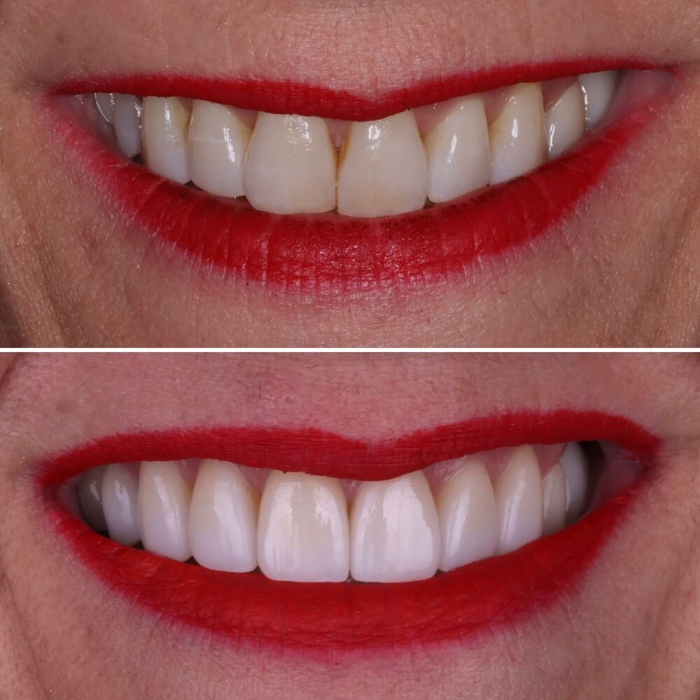 A result from Chase Inspired Dentistry