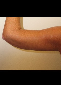 A result from Kelly R. Kunkel, MD, PA