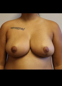 A result from Kelly R. Kunkel, MD, PA