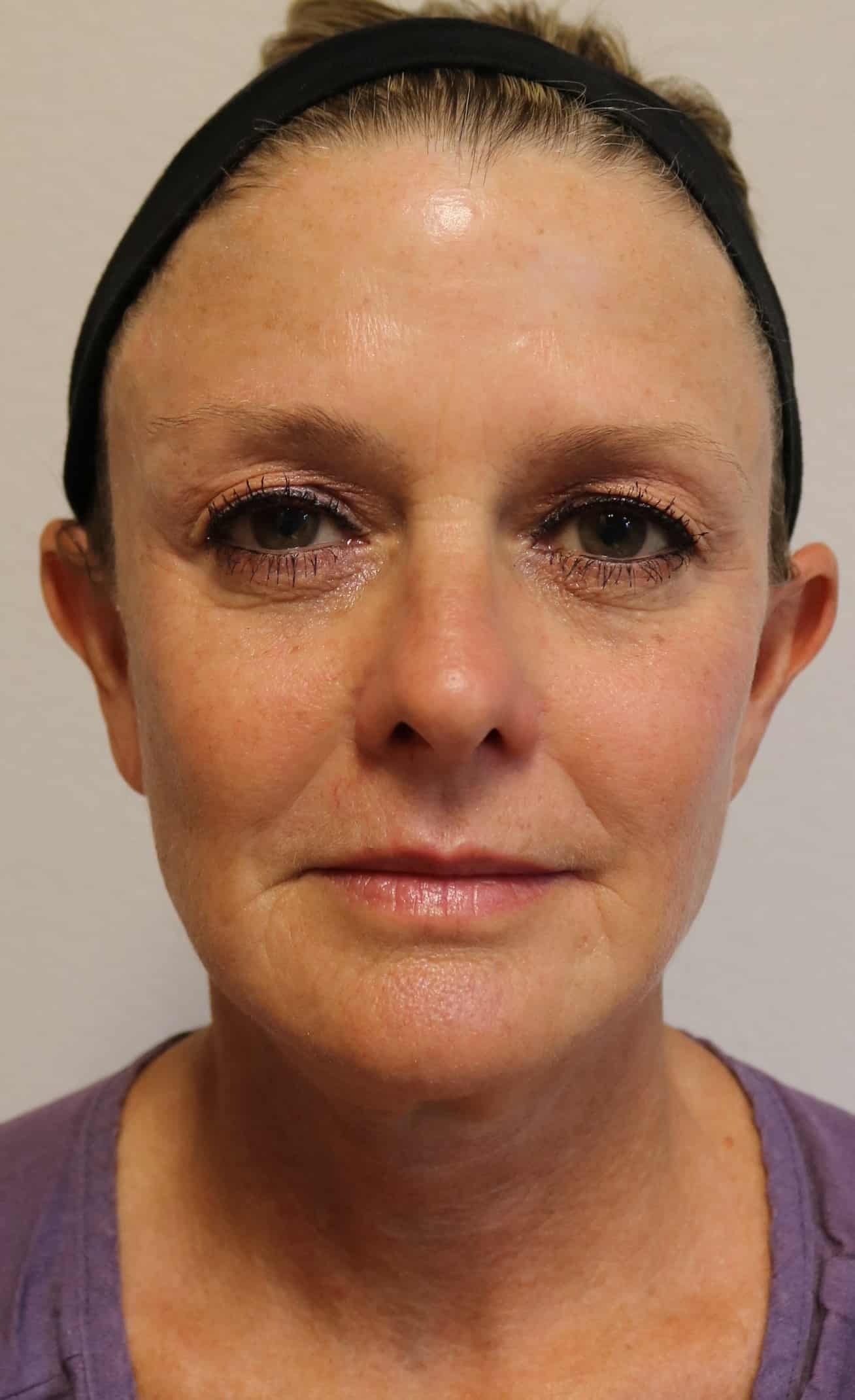 A result from Kelly R. Kunkel, MD, PA