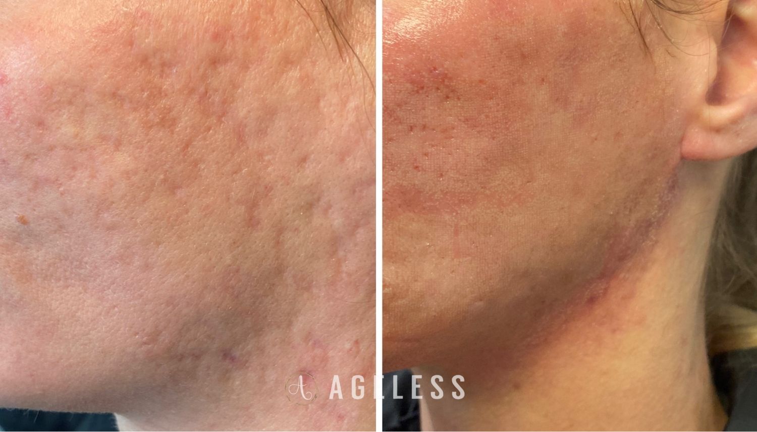 A result from Ageless Aesthetics