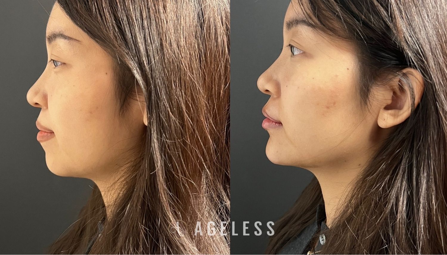 A result from Ageless Aesthetics