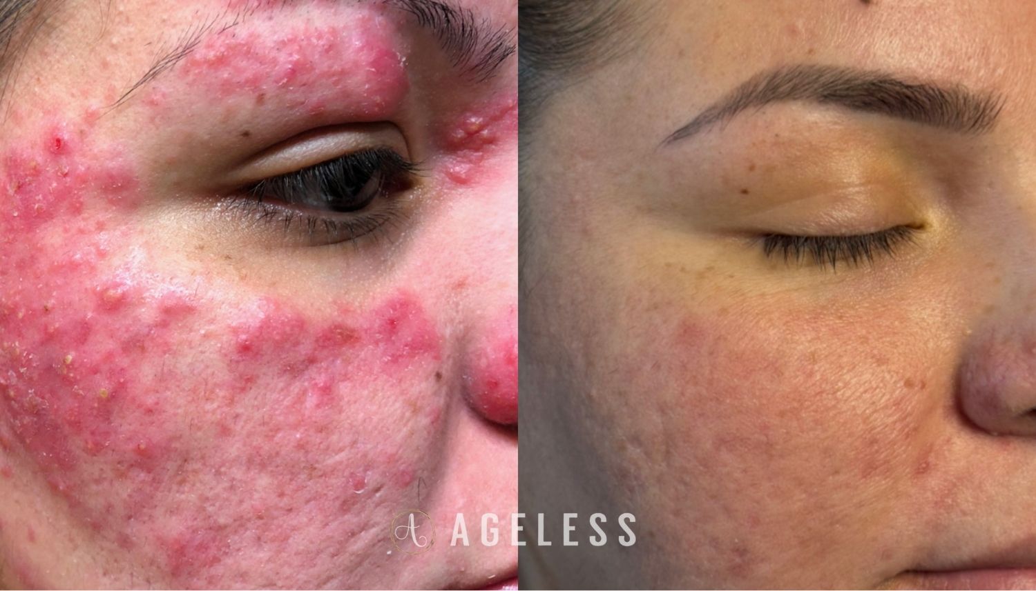 A result from Ageless Aesthetics