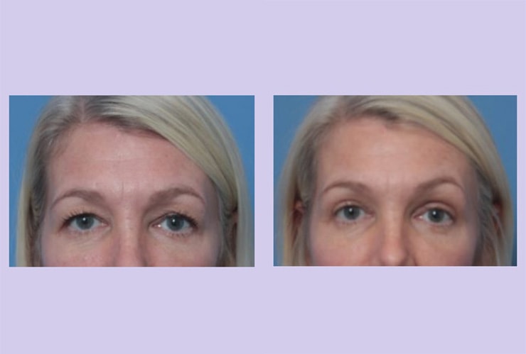 A result from Dr. Anthony S. Youn, MD
