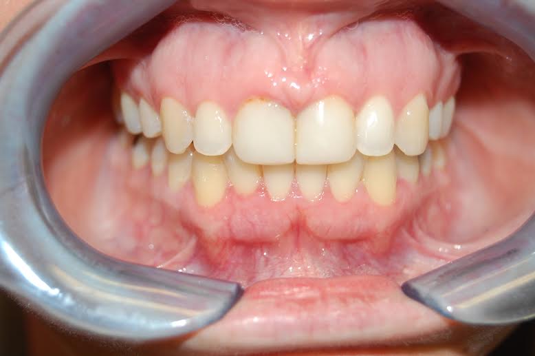A result from Berry Farms Dental
