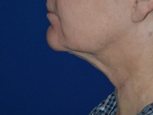 A result from Karol Gutowski, MD