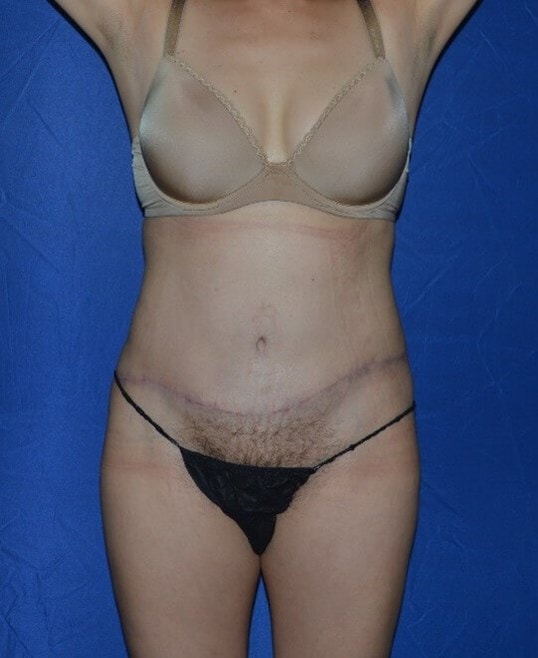 A result from Karol Gutowski, MD