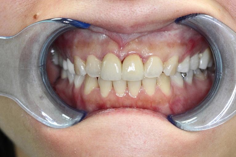 A result from Formosa Dental Arts
