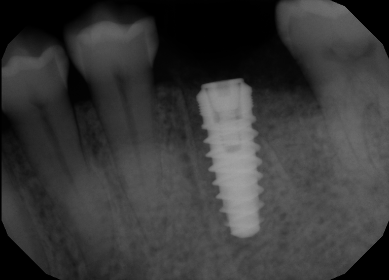 A result from Formosa Dental Arts