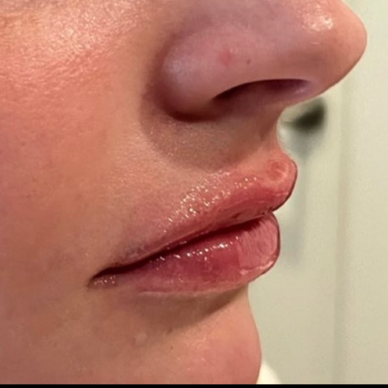 A result from Summit Medical Spa