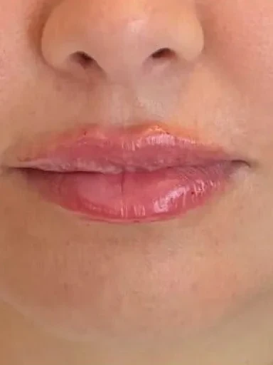 A result from Esthetic Finesse