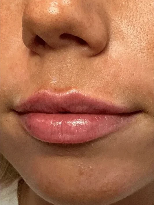 A result from Esthetic Finesse