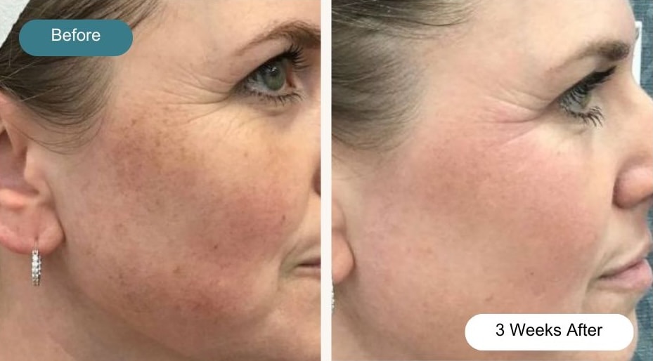 A result from Dvida Spa | Med Spa Services 60654