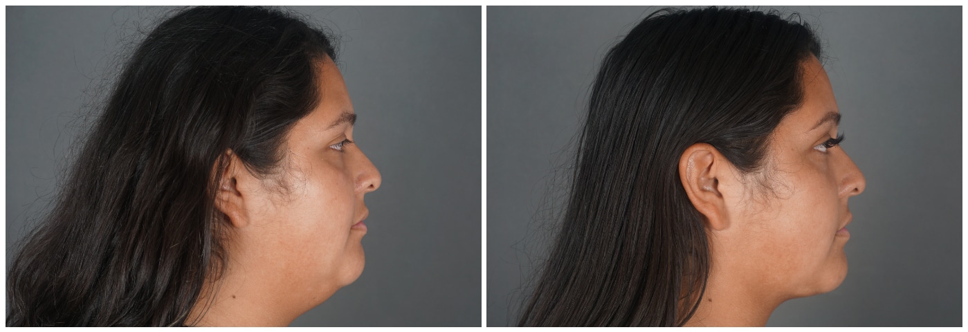 Dr. Ashley Steinberg - Trouvaille Aesthetics & Plastic Surgery provider photo