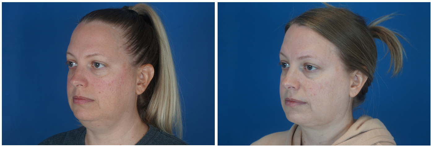 Dr. Ashley Steinberg - Trouvaille Aesthetics & Plastic Surgery provider photo