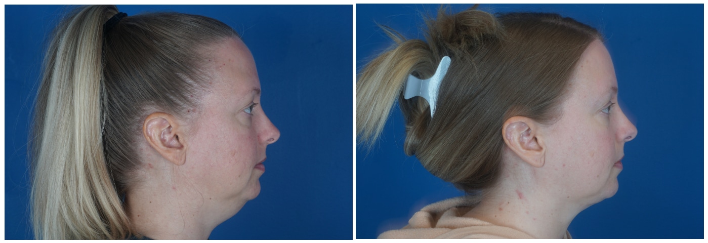 Dr. Ashley Steinberg - Trouvaille Aesthetics & Plastic Surgery provider photo