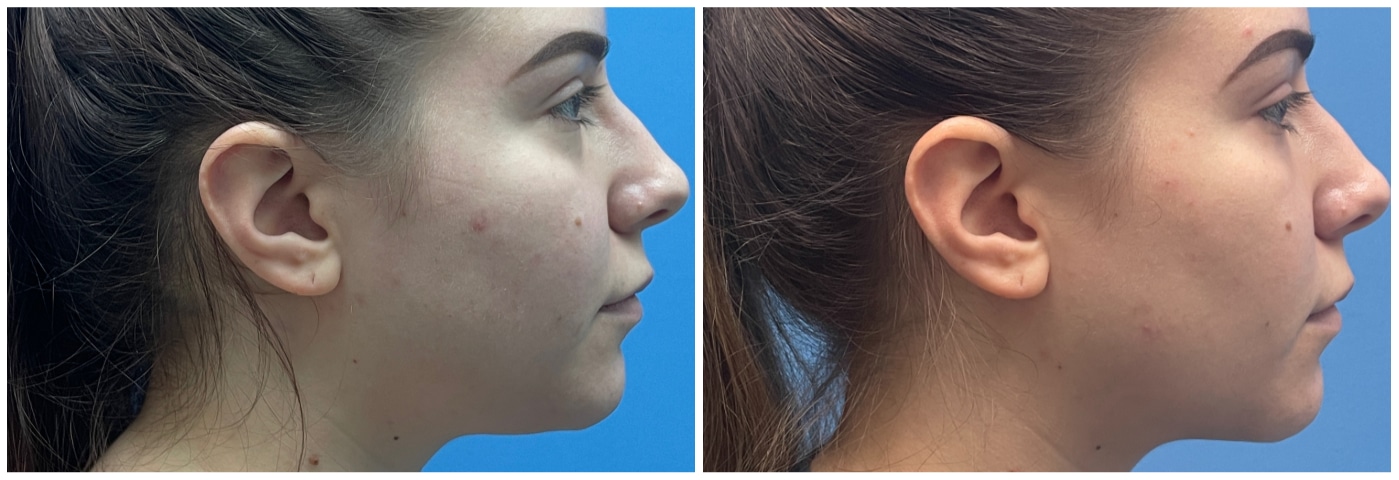 Dr. Ashley Steinberg - Trouvaille Aesthetics & Plastic Surgery provider photo