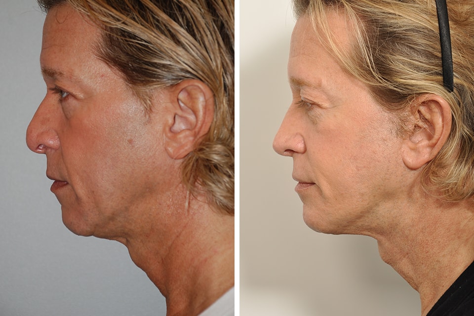 A result from David B. Rosenberg, MD