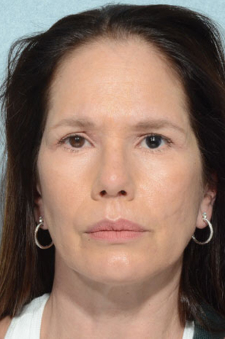Chegar Facial Plastic Surgery provider photo
