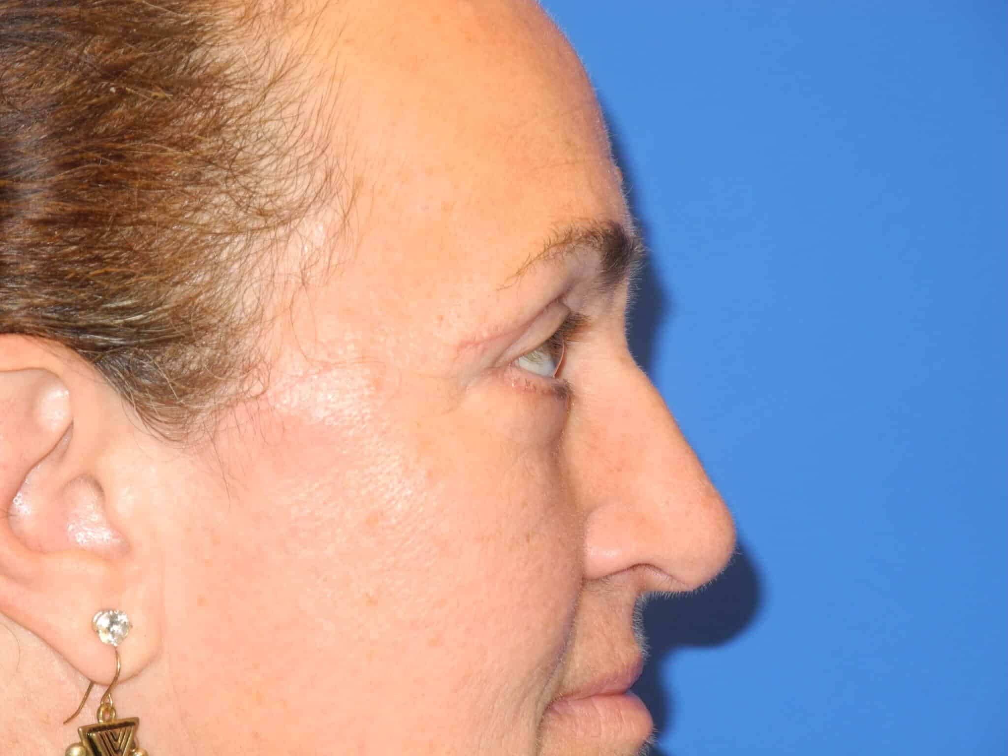 A result from Shahram Salemy, MD