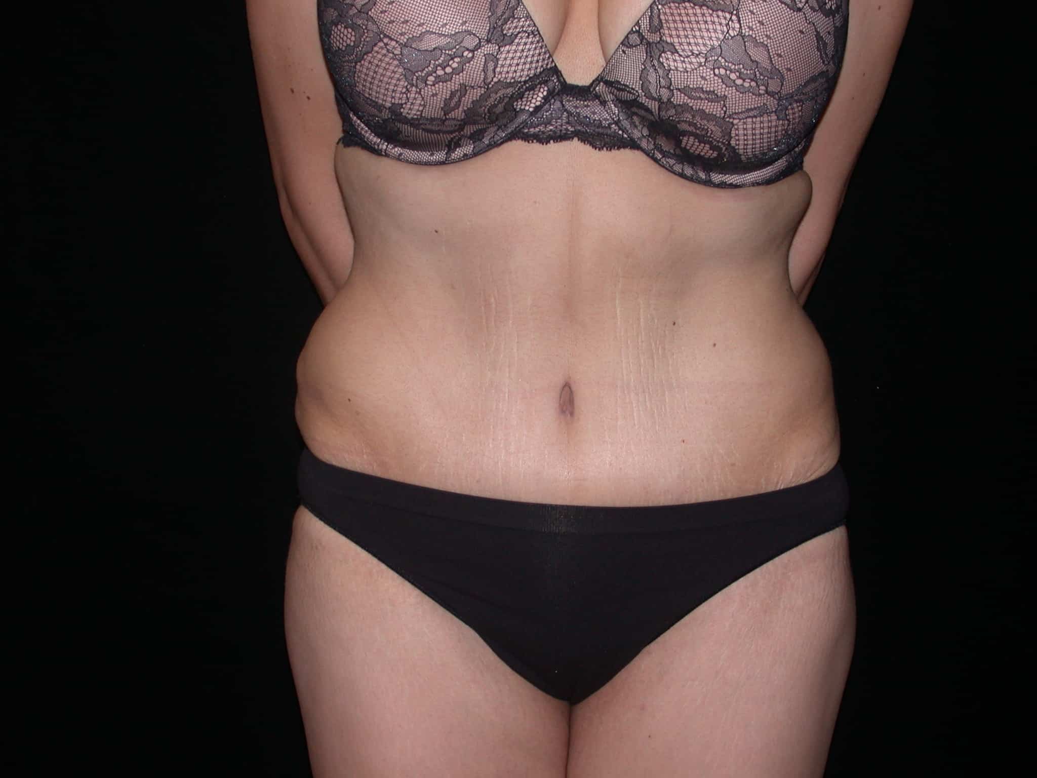 A result from Shahram Salemy, MD
