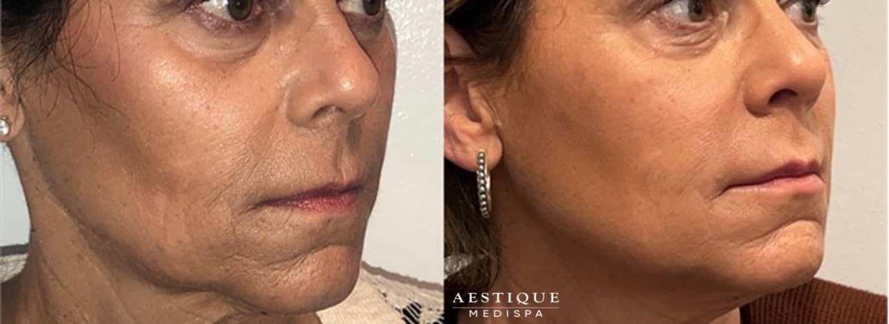 Aestique Medispa provider photo