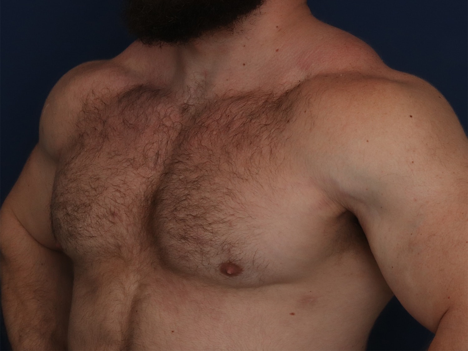 A result from Ronald H. Schuster, MD