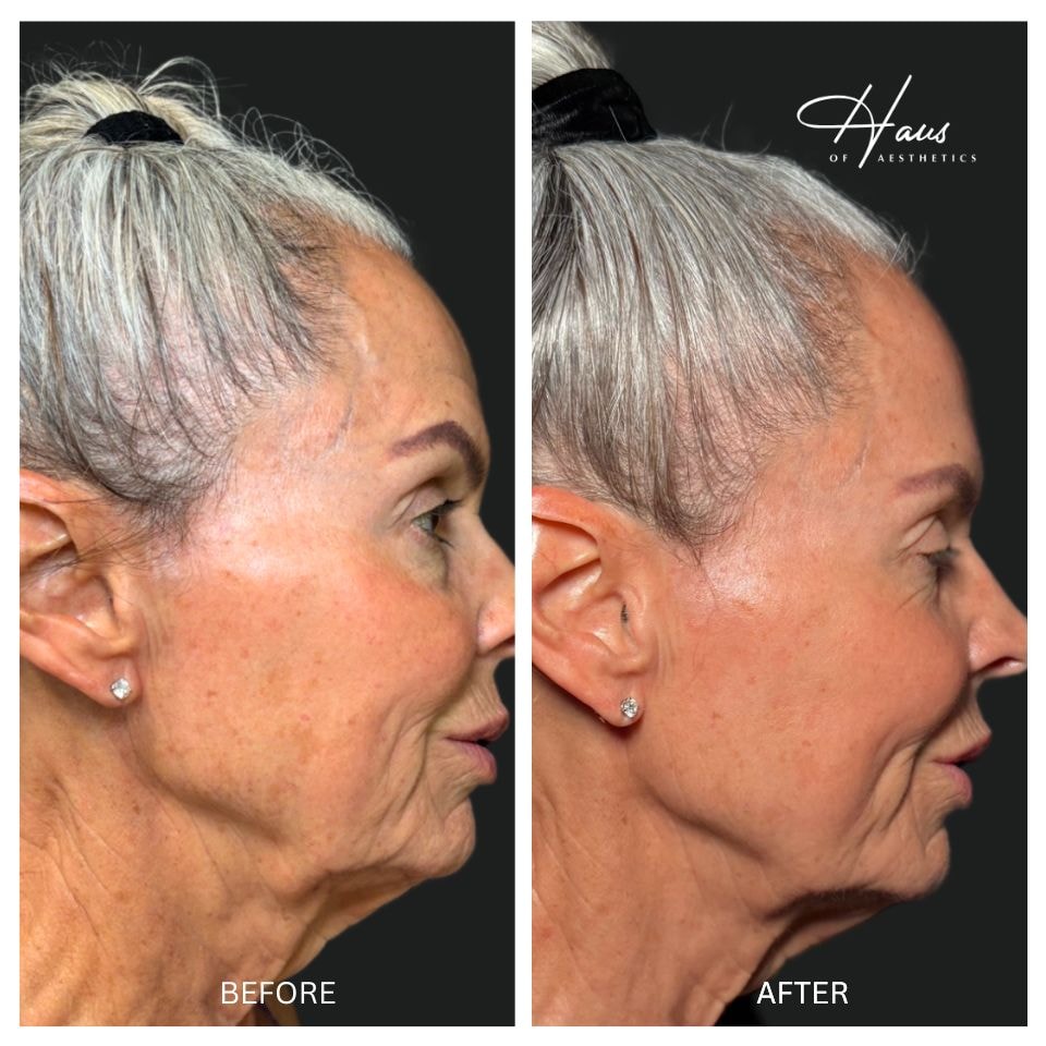 A result from Haus of Aesthetics