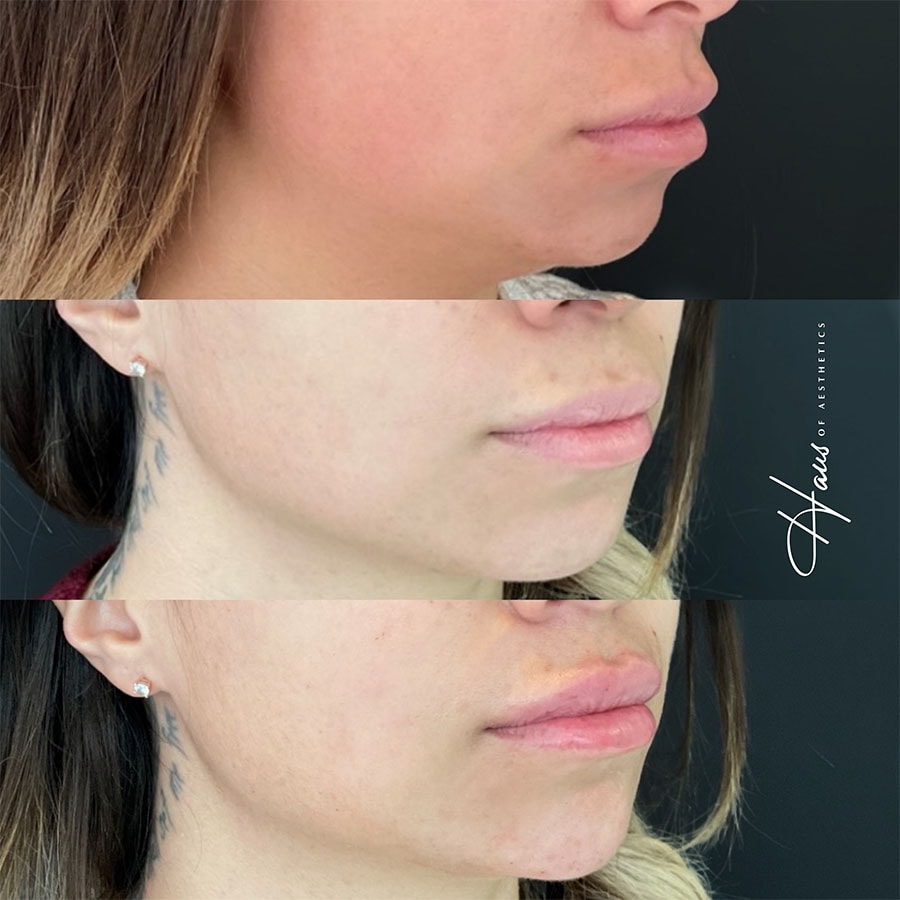 A result from Haus of Aesthetics