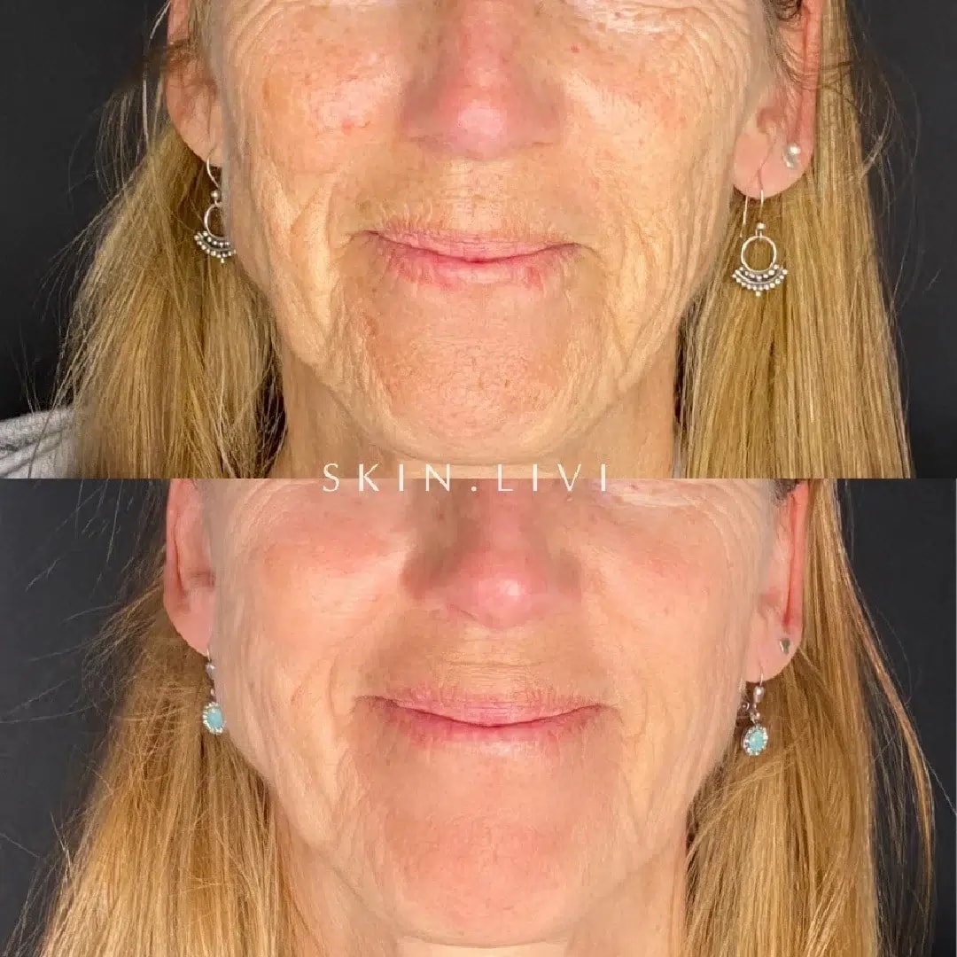A result from Haus of Aesthetics