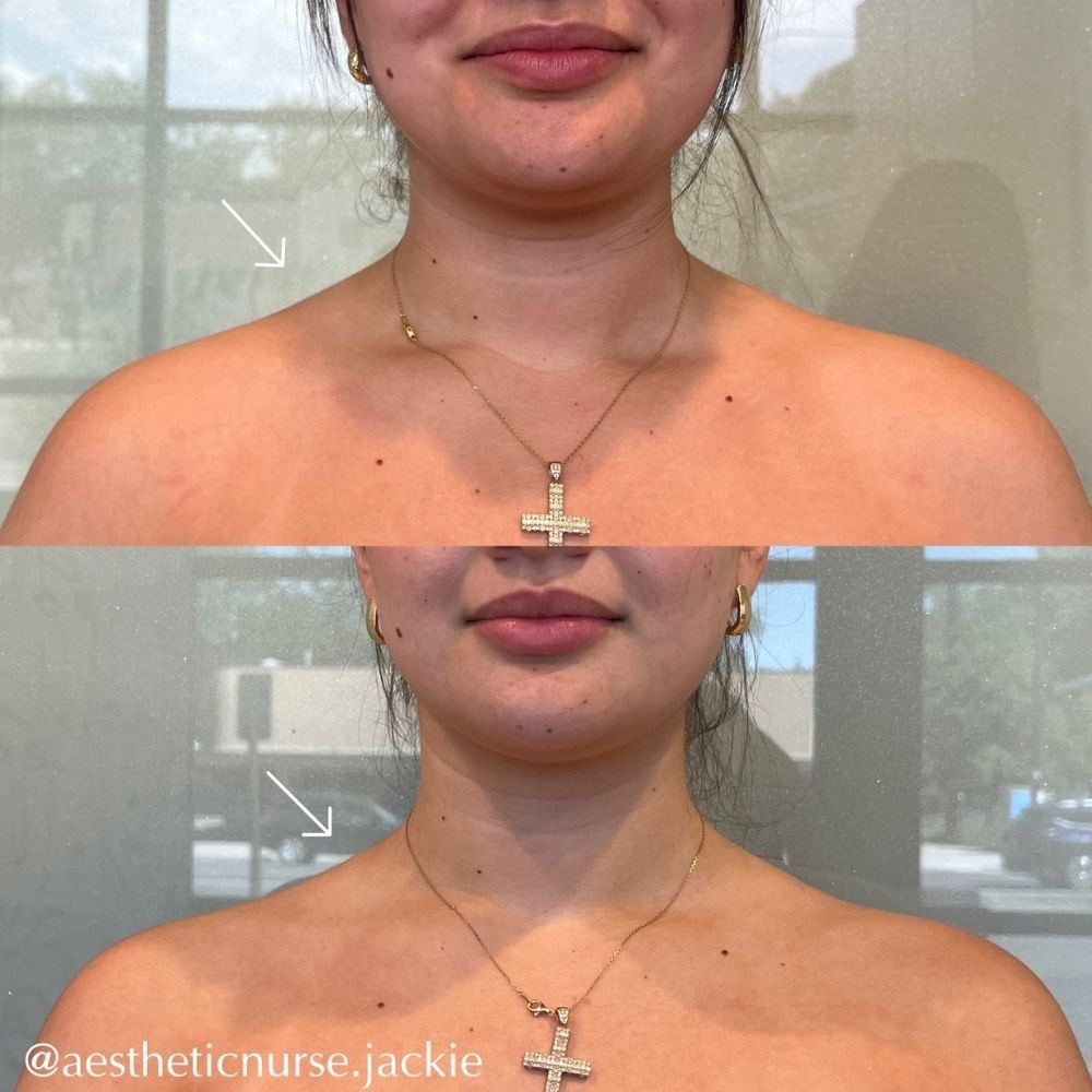 A result from Haus of Aesthetics
