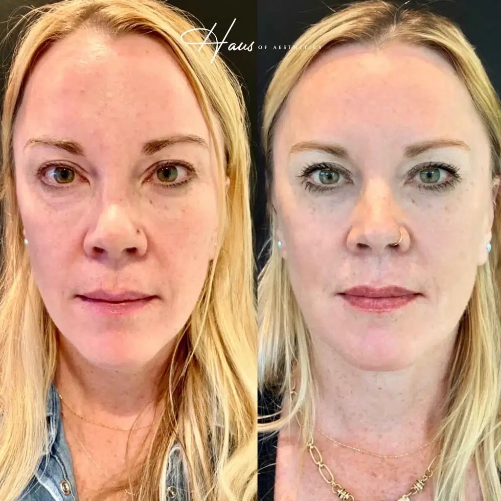 A result from Haus of Aesthetics