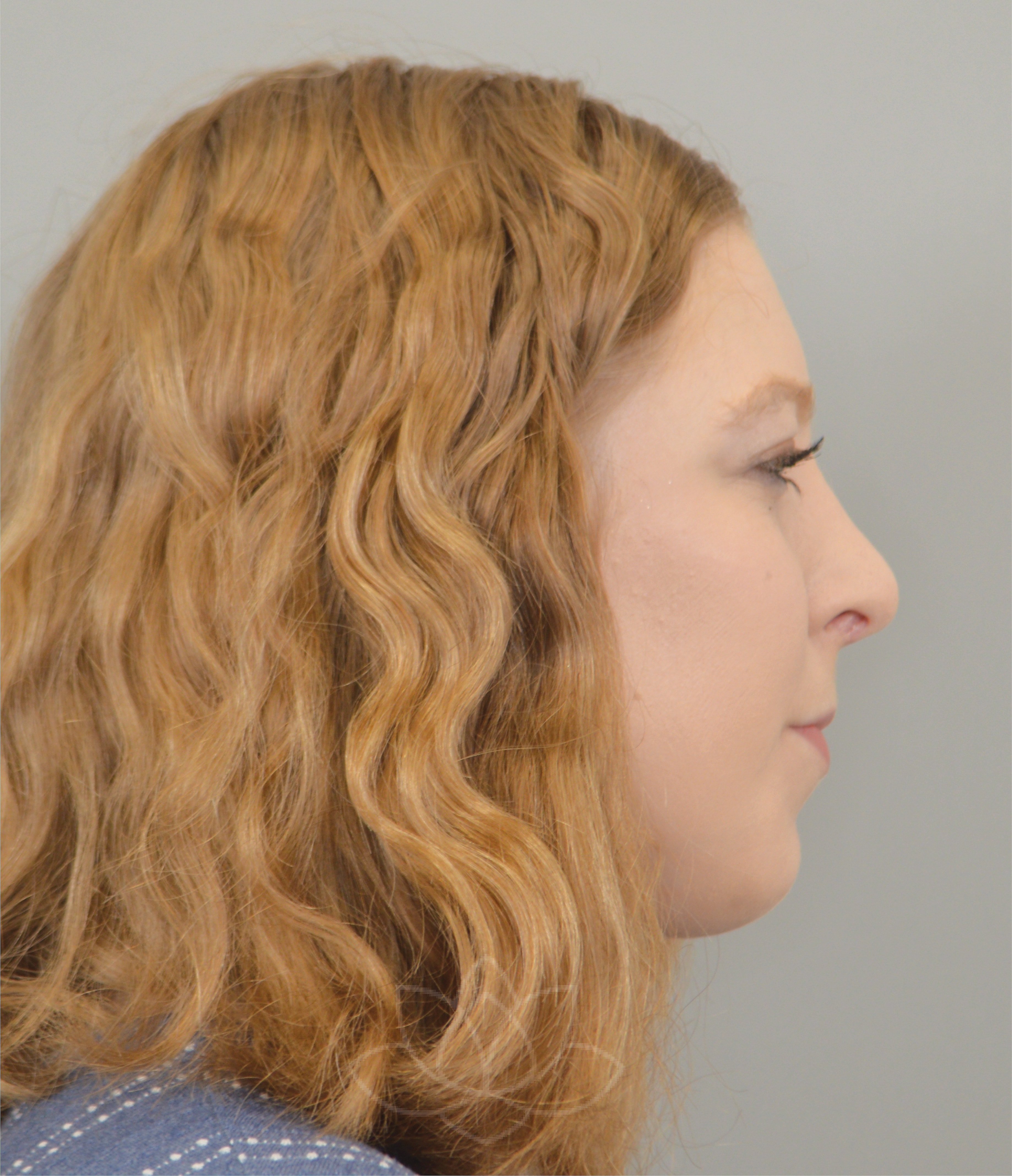 A result from Jordan L. Wallin, MD