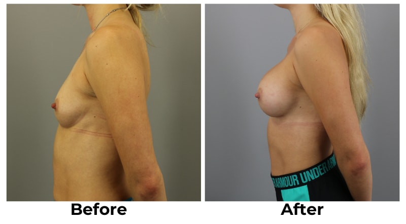 A result from Webb Plastic Surgery