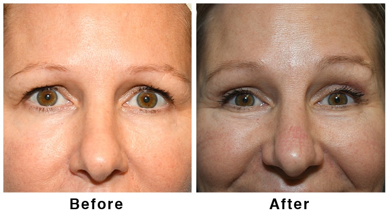 A result from Webb Plastic Surgery
