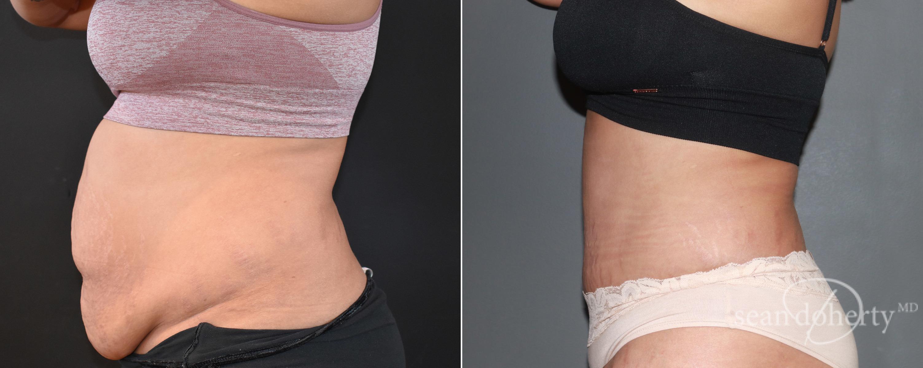 Dr. Sean Doherty - Plastic Surgery provider photo