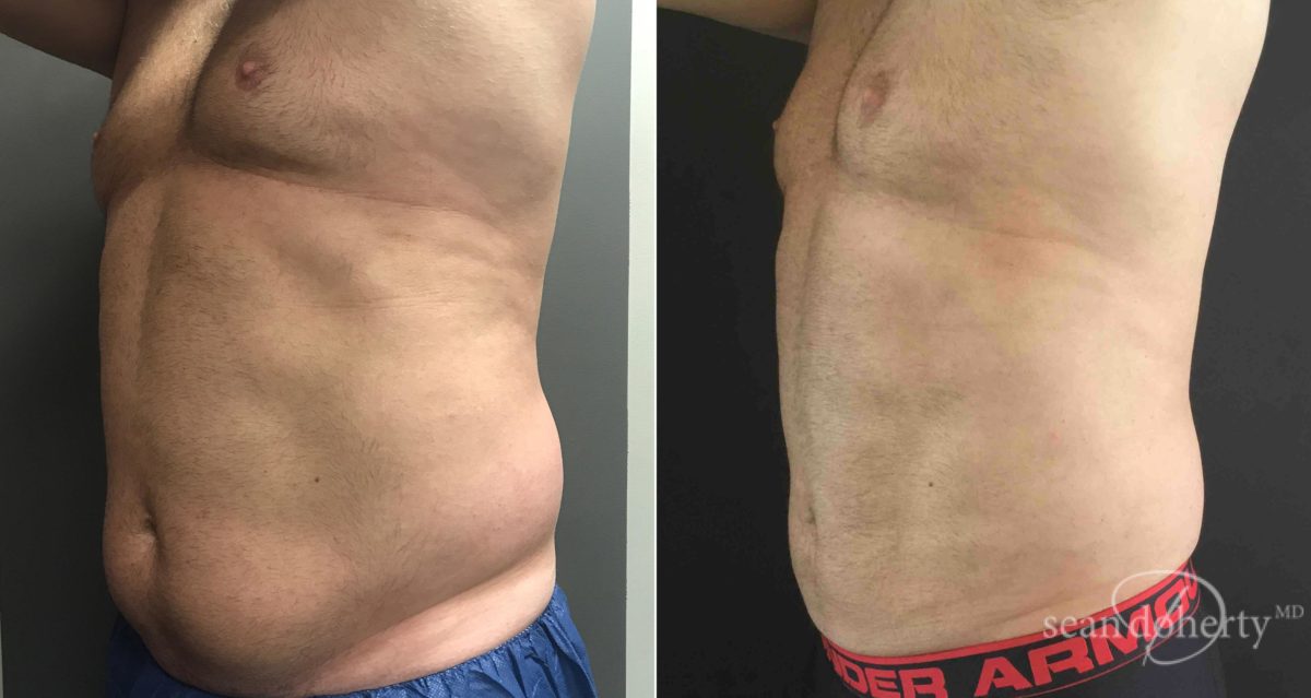 Dr. Sean Doherty - Plastic Surgery provider photo