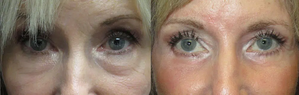 OPAL Aesthetics - East Cobb provider photo