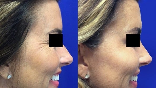 A result from Southlake Plastic Surgery