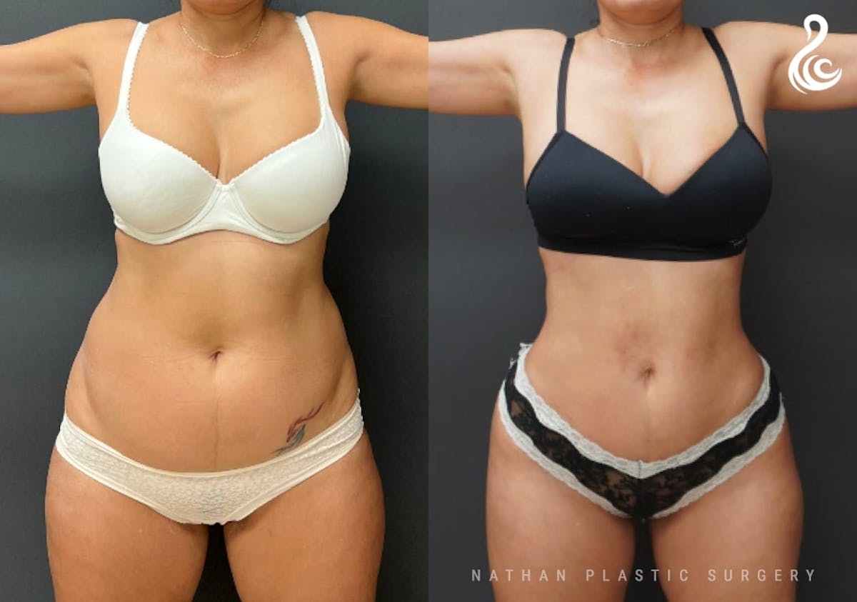 A result from Dr. Nathan