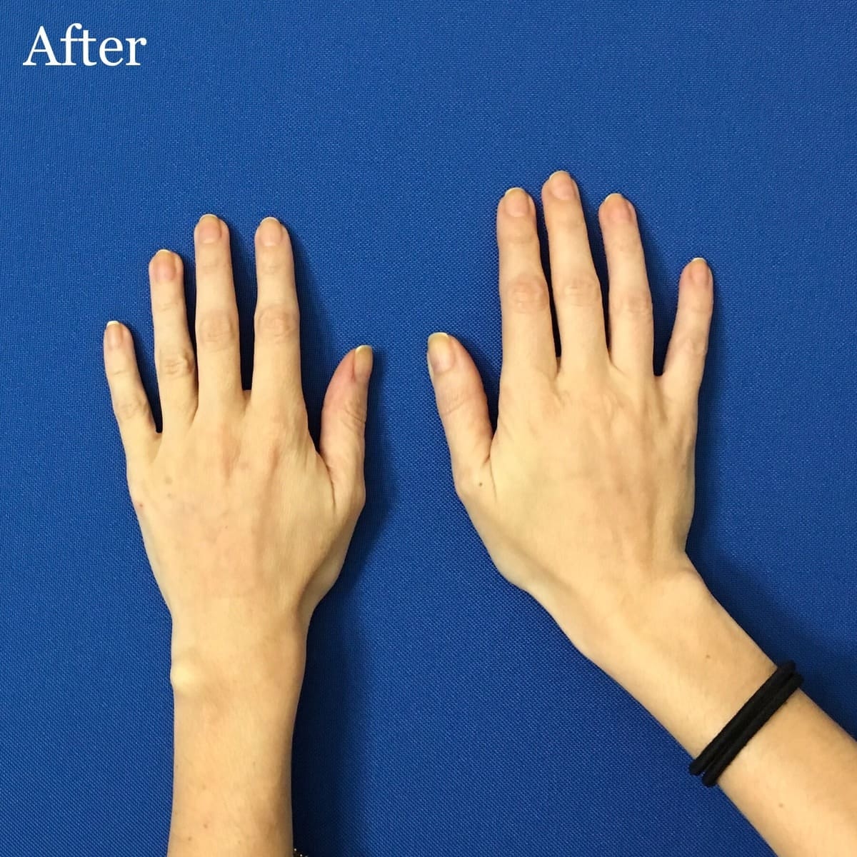 A result from Los Angeles Plastic Surgery