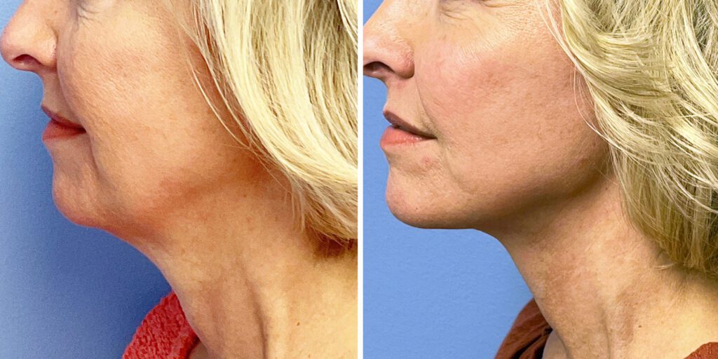 Bluemont Plastic Surgery provider photo