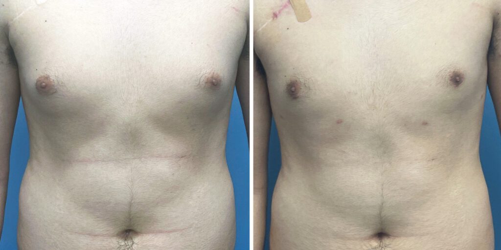 A result from Bluemont Plastic Surgery