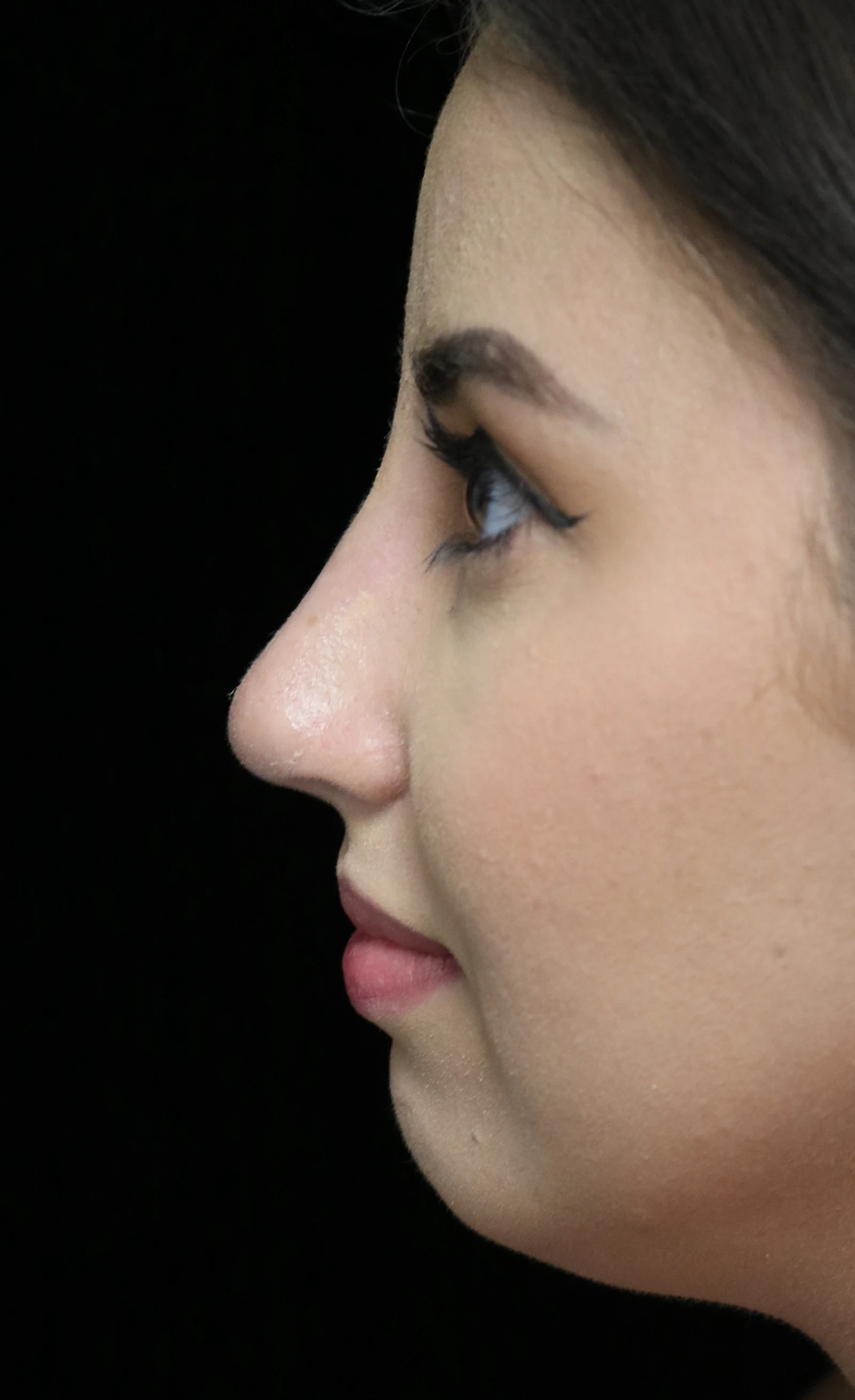 A result from ScarlessNose - Dr. Deepak Dugar