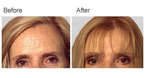 A result from Zubowicz Plastic Surgery