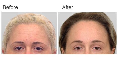 A result from Zubowicz Plastic Surgery