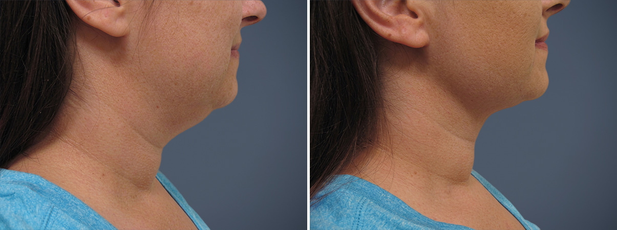 A result from David W. Allison, MD