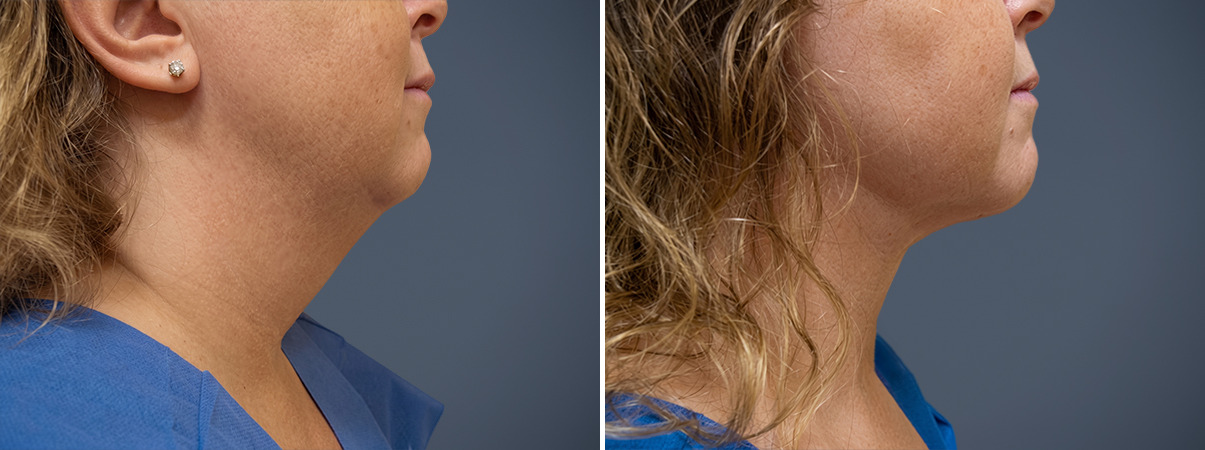 A result from David W. Allison, MD