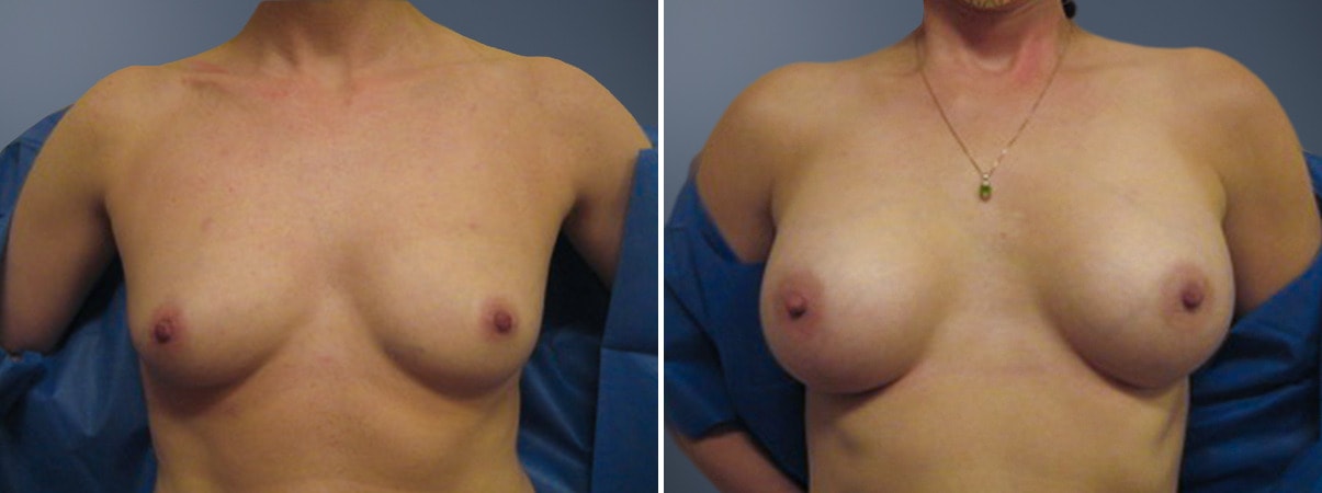A result from David W. Allison, MD
