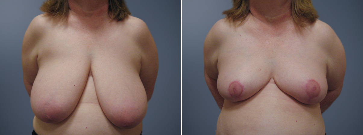 A result from David W. Allison, MD